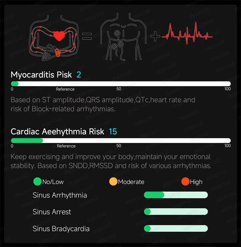 Smart Watch Men High-end Health Blood Pressure Blood Oxygen Lipids Uric Acid Sapphire Smart Watches Ai GPT Custom Dial ECG 2026